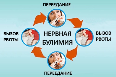 Лечение булимии в Баранчинском